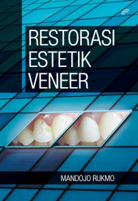 Restorasi estetik veneer